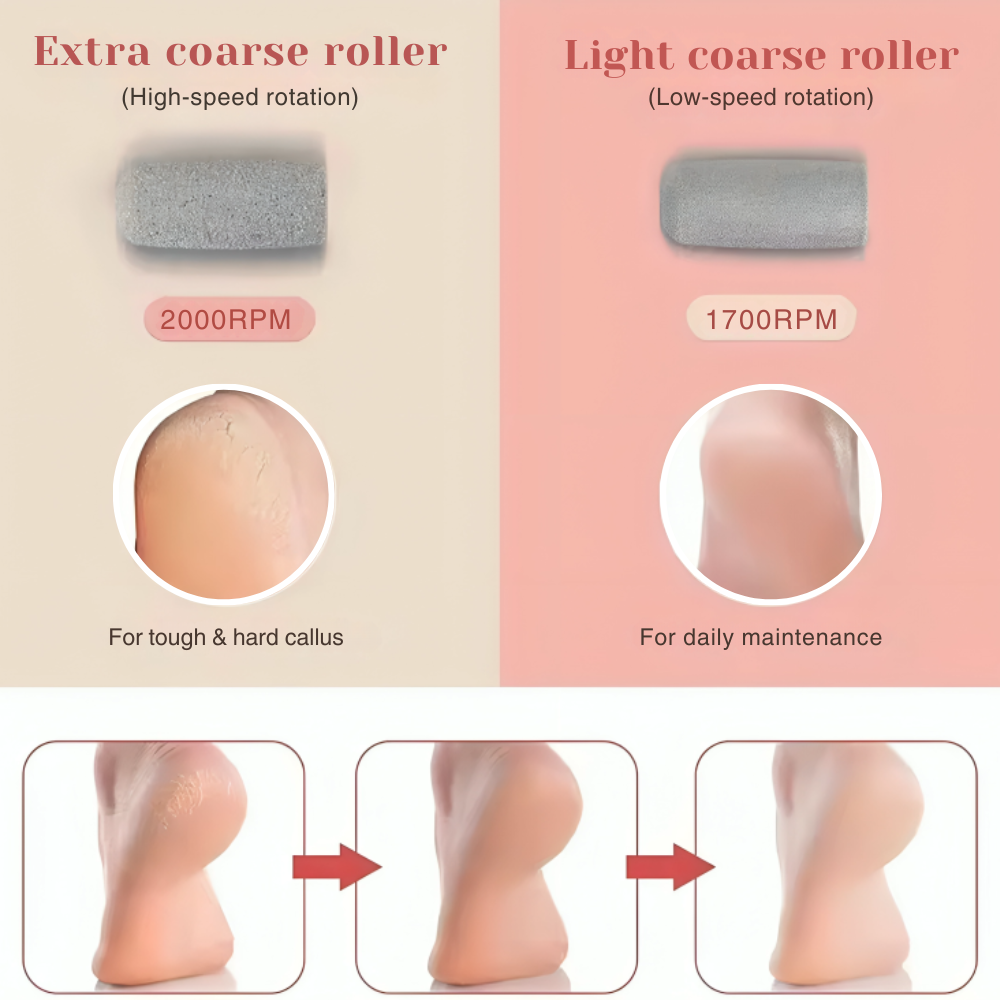 Electric Callus Remover