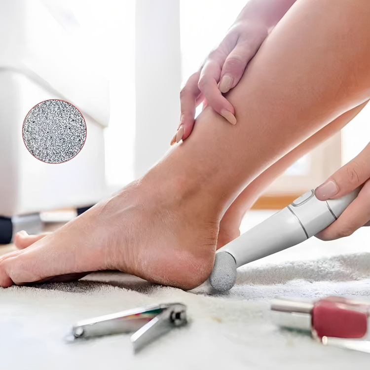 Electric Callus Remover